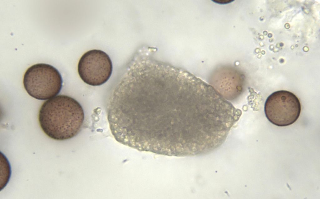 Physarum hongkongense